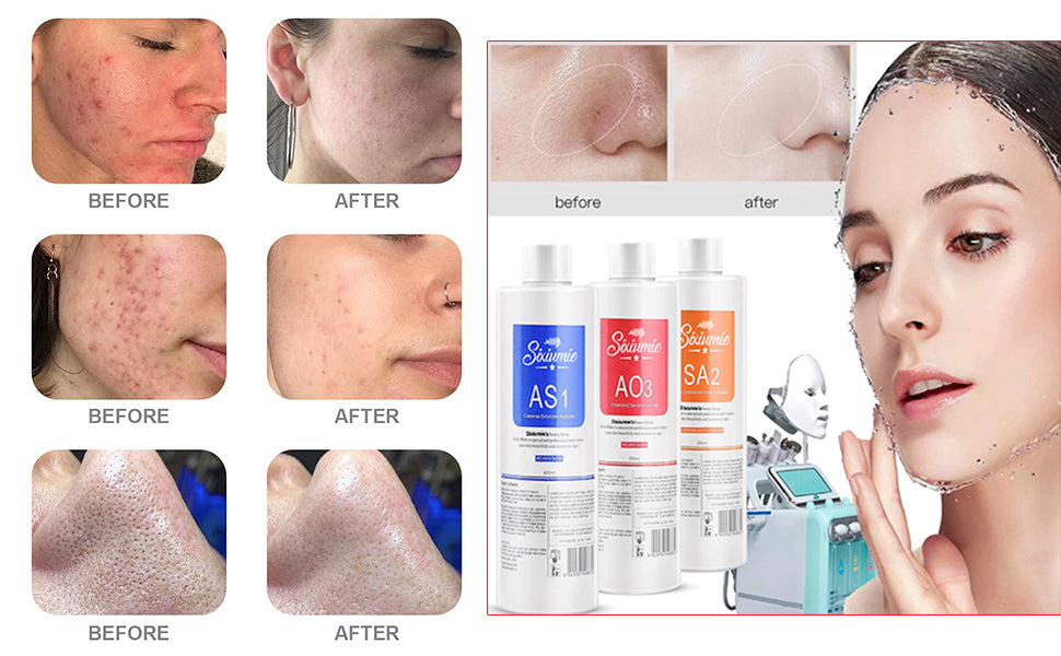 Pinjaze Hydrogen Oxygen Facial Machine Serums for Facial Cleansing