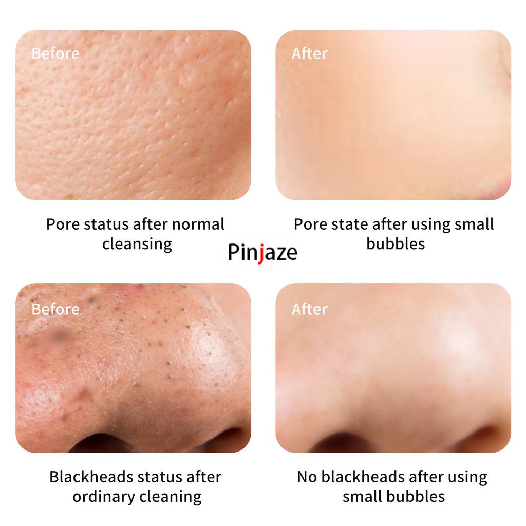 Pinjaze 7 in 1 Hydrogen Oxygen Facial Machine