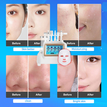 Pinjaze 7 in 1 Hydrogen Oxygen Facial Machine